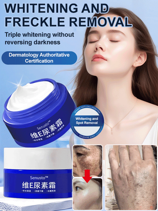【Old Spots and Yellow Spots Disappear】Spot Fading Urea Cream